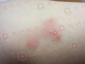 ���ݱ���Ƥ����