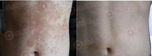 ���ݱ���Ƥ����