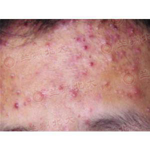 ���ݱ���Ƥ����