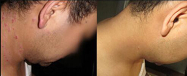 ���ݱ���Ƥ����