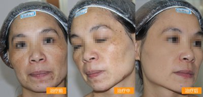 ���ݱ���Ƥ����