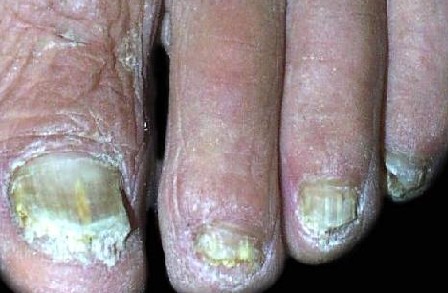 ���ݱ���Ƥ����