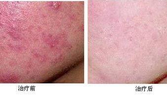 ���ݱ���Ƥ����