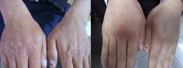 ���ݱ���Ƥ����