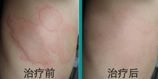 ���ݱ���Ƥ����