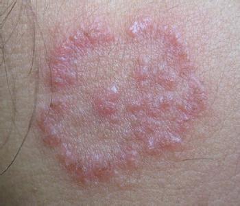 ���ݱ���Ƥ����