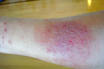 ���ݱ���Ƥ����