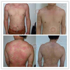 ���ݱ���Ƥ����