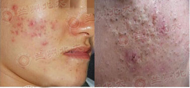 ���ݱ���Ƥ����