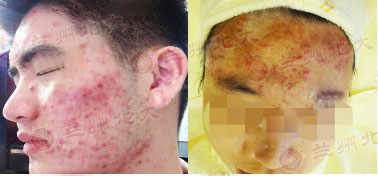 ���ݱ���Ƥ����