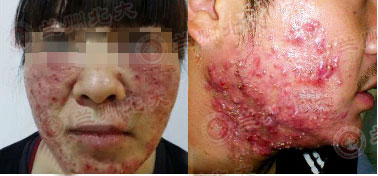 ���ݱ���Ƥ����