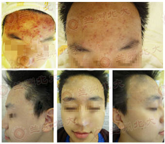 ���ݱ���Ƥ����