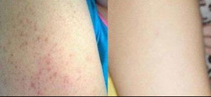 ���ݱ���Ƥ����