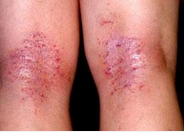 ���ݱ���Ƥ����