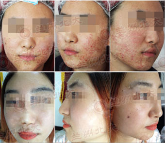 ���ݱ���Ƥ����