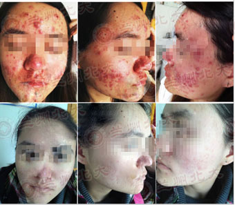 ���ݱ���Ƥ����