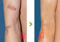 ���ݱ���Ƥ����