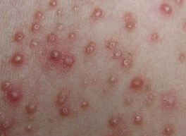 ���ݱ���Ƥ����