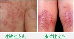 ���ݱ���Ƥ����