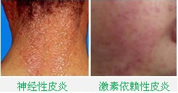 ���ݱ���Ƥ����