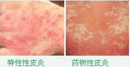 ���ݱ���Ƥ����