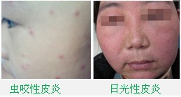 ���ݱ���Ƥ����