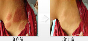 ���ݱ���Ƥ����