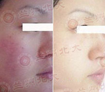 ���ݱ���Ƥ����