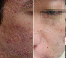 ���ݱ���Ƥ����