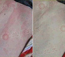 ���ݱ���Ƥ����