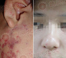 ���ݱ���Ƥ����