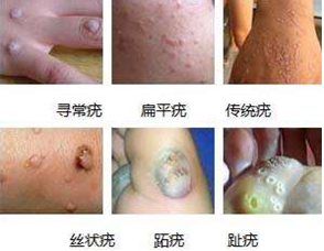 ���ݱ���Ƥ����