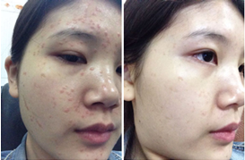 ���ݱ���Ƥ����