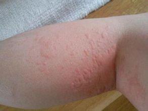 ���ݱ���Ƥ����