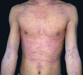 ���ݱ���Ƥ����