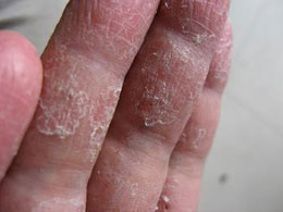 ���ݱ���Ƥ����