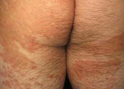 ���ݱ���Ƥ����