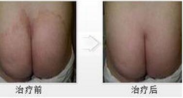 ���ݱ���Ƥ����