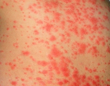 ���ݱ���Ƥ����