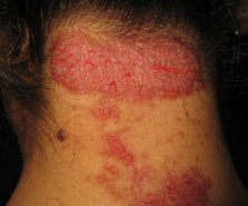 ���ݱ���Ƥ����