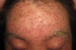 ���ݱ���Ƥ����