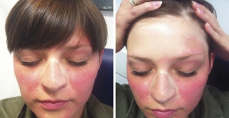 ���ݱ���Ƥ����