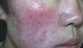 ���ݱ���Ƥ����