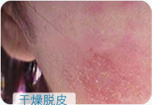 ���ݱ���Ƥ����