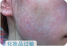 ���ݱ���Ƥ����