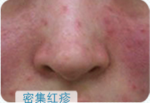 ���ݱ���Ƥ����