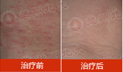 ���ݱ���Ƥ����