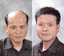 ���ݱ���Ƥ����