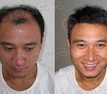 ���ݱ���Ƥ����