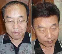 ���ݱ���Ƥ����